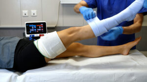 Esmarch leg